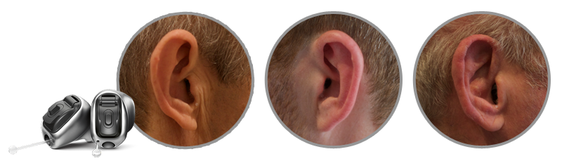 Phonak Virto B-Ti IIC hearing aids and photos of them hidden in ear canals