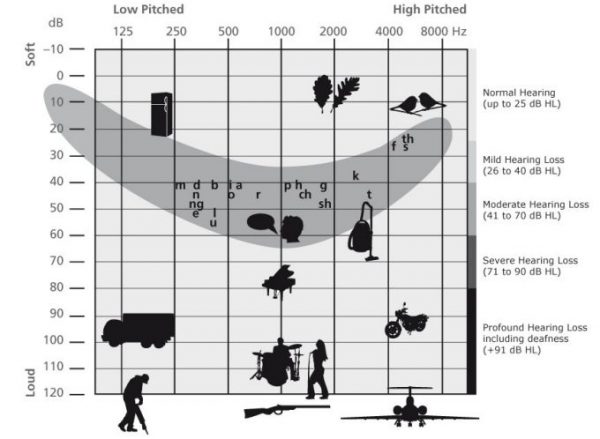 understanding-the-different-levels-of-hearing-loss-davidson-hearing