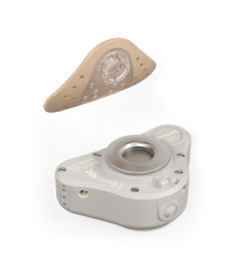 Med-El ADHEAR bone conduction hearing aid